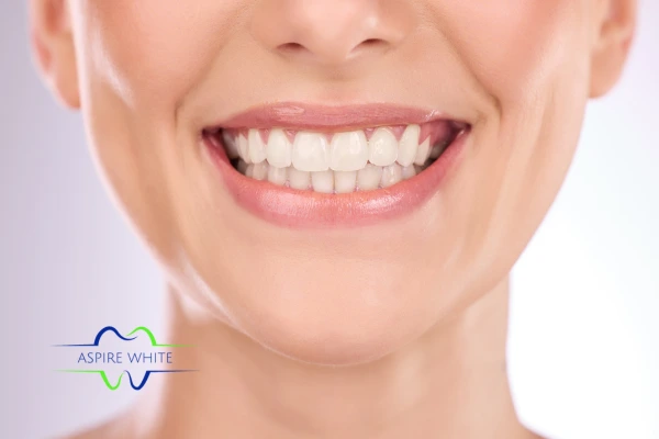 Follow your teeth whitening aftercare Bradford to prolong your whiter smile!