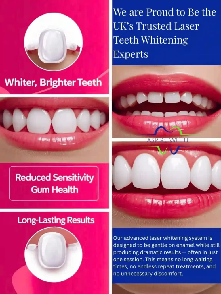 We are Proud to Be the UK’s Trusted Laser Teeth Whitening Experts Bradford